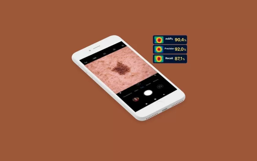 aplicativo-ia-cancer-de-pele